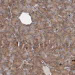 BAP29 Antibody in Immunohistochemistry (IHC)