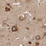 BAP29 Antibody in Immunohistochemistry (IHC)