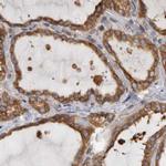 BAP29 Antibody in Immunohistochemistry (IHC)