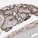 COG1 Antibody in Immunohistochemistry (Paraffin) (IHC (P))