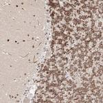 USF3 Antibody in Immunohistochemistry (IHC)