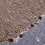 KIF13A Antibody in Immunohistochemistry (Paraffin) (IHC (P))