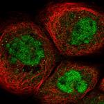 SPT5 Antibody in Immunocytochemistry (ICC/IF)