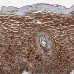 USP47 Antibody in Immunohistochemistry (Paraffin) (IHC (P))