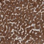 USP47 Antibody in Immunohistochemistry (Paraffin) (IHC (P))