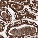 USP47 Antibody in Immunohistochemistry (Paraffin) (IHC (P))