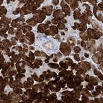 Asparagine Synthetase Antibody in Immunohistochemistry (IHC)