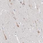 Asparagine Synthetase Antibody in Immunohistochemistry (IHC)