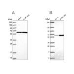 Asparagine Synthetase Antibody in Western Blot (WB)