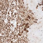 ATP9B Antibody in Immunohistochemistry (Paraffin) (IHC (P))