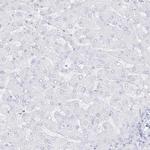 DMKN Antibody in Immunohistochemistry (IHC)