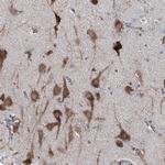 AGPAT9 Antibody in Immunohistochemistry (Paraffin) (IHC (P))