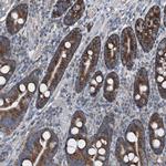 AGPAT9 Antibody in Immunohistochemistry (Paraffin) (IHC (P))