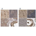 TCP-1 theta Antibody in Immunohistochemistry (IHC)