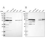 TCP-1 theta Antibody in Western Blot (WB)