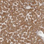 SEMA3A Antibody in Immunohistochemistry (Paraffin) (IHC (P))