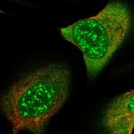 SMC4 Antibody in Immunocytochemistry (ICC/IF)