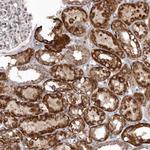 SMC4 Antibody in Immunohistochemistry (Paraffin) (IHC (P))