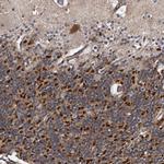 KV4.3 (KCND3) Antibody in Immunohistochemistry (IHC)