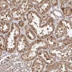 MACC1 Antibody in Immunohistochemistry (Paraffin) (IHC (P))