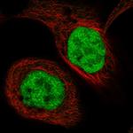 Transketolase Antibody in Immunocytochemistry (ICC/IF)