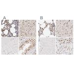 Transketolase Antibody in Immunohistochemistry (IHC)