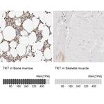 Transketolase Antibody