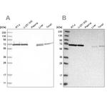 Transketolase Antibody in Western Blot (WB)