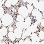 Transketolase Antibody in Immunohistochemistry (IHC)