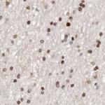 Transketolase Antibody in Immunohistochemistry (IHC)