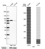 Transketolase Antibody in Western Blot (WB)