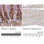 BAIAP2L1 Antibody