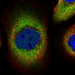 PSPH Antibody in Immunocytochemistry (ICC/IF)