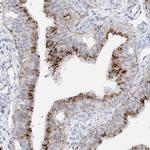 PSPH Antibody in Immunohistochemistry (Paraffin) (IHC (P))