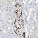 PSPH Antibody in Immunohistochemistry (Paraffin) (IHC (P))