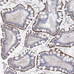 PSPH Antibody in Immunohistochemistry (Paraffin) (IHC (P))