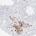 PSPH Antibody in Immunohistochemistry (Paraffin) (IHC (P))