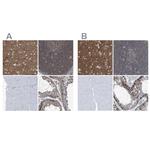 Septin-7 Antibody in Immunohistochemistry (IHC)