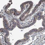 Septin-7 Antibody in Immunohistochemistry (IHC)