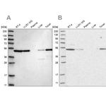 Septin-7 Antibody in Western Blot (WB)