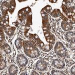 CPNE3 Antibody in Immunohistochemistry (IHC)