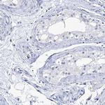 IMPA2 Antibody in Immunohistochemistry (Paraffin) (IHC (P))