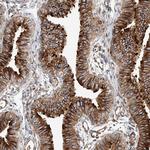 HGSNAT Antibody in Immunohistochemistry (Paraffin) (IHC (P))