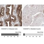 HGSNAT Antibody