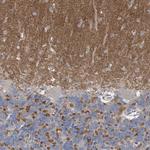 PCLO Antibody in Immunohistochemistry (Paraffin) (IHC (P))