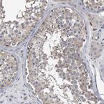 PCLO Antibody in Immunohistochemistry (Paraffin) (IHC (P))