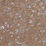 PCLO Antibody in Immunohistochemistry (IHC)