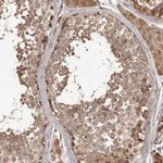 QRSL1 Antibody in Immunohistochemistry (Paraffin) (IHC (P))