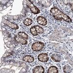 USP45 Antibody in Immunohistochemistry (IHC)