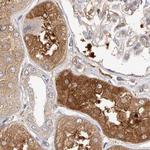 LAP3 Antibody in Immunohistochemistry (IHC)